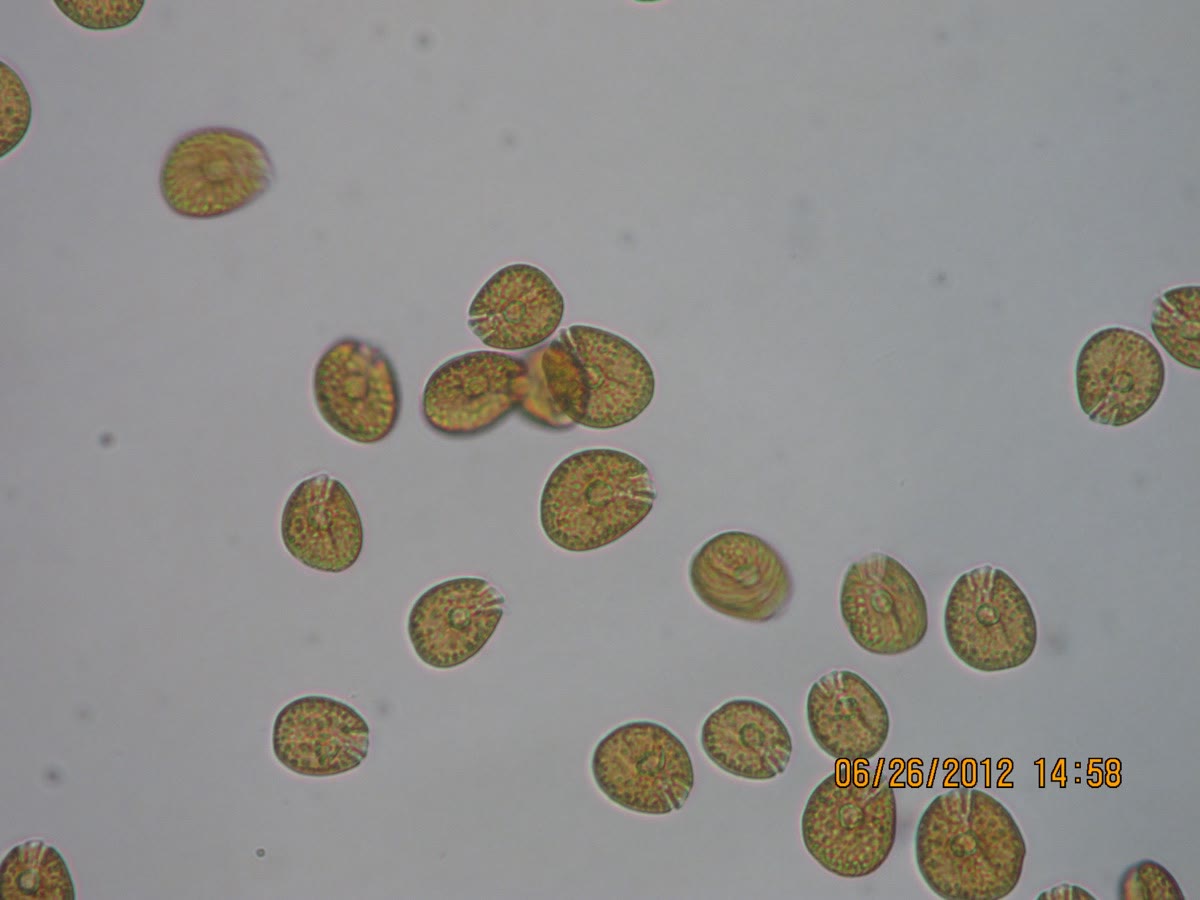 Amphidinium sp. cells