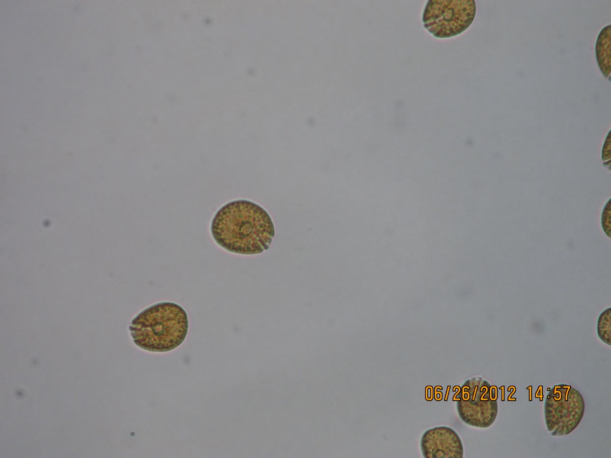 Amphidinium sp. cells