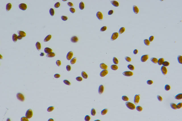 Ostreopsis sp. at low magnification