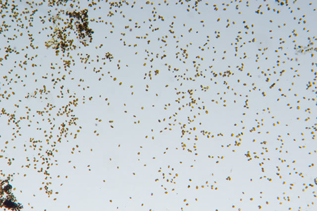 Ostreopsis sp. at low magnification