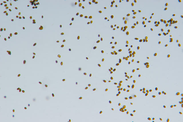 Ostreopsis sp. at low magnification