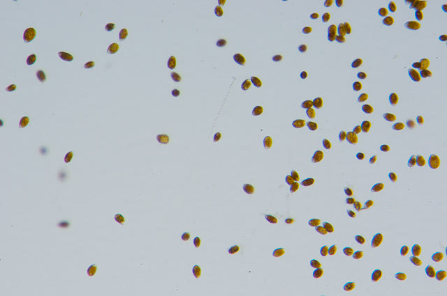 Ostreopsis sp. at low magnification