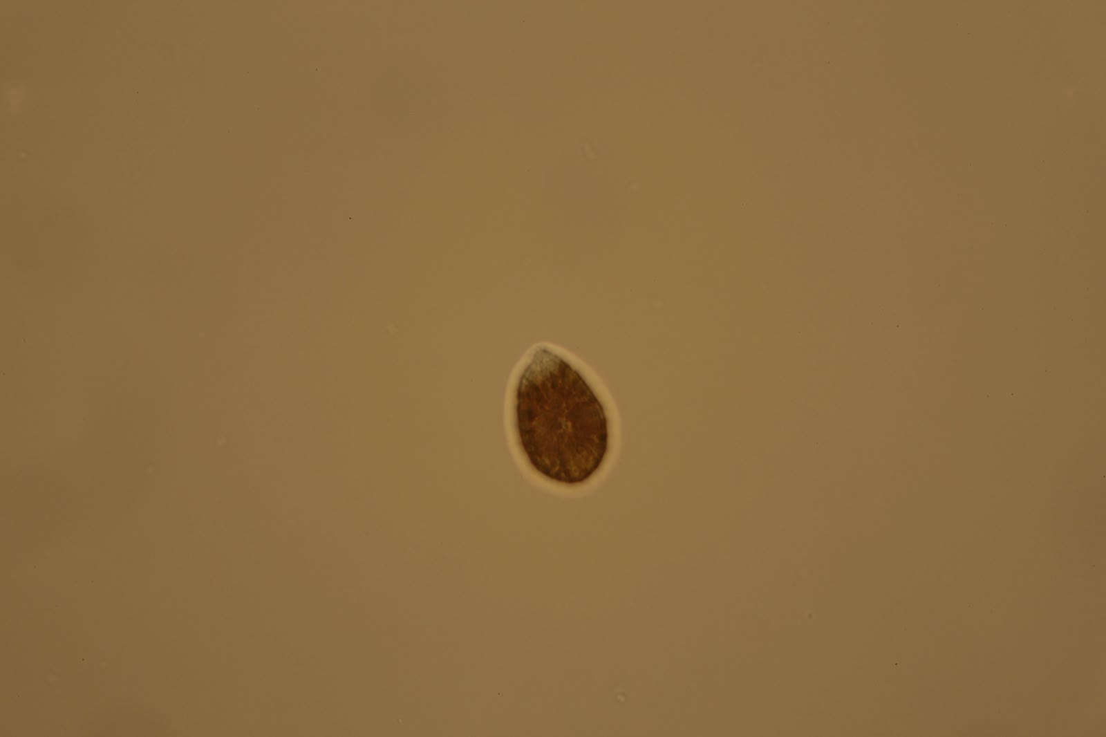 Ostreopsis sp. cells at high magnification