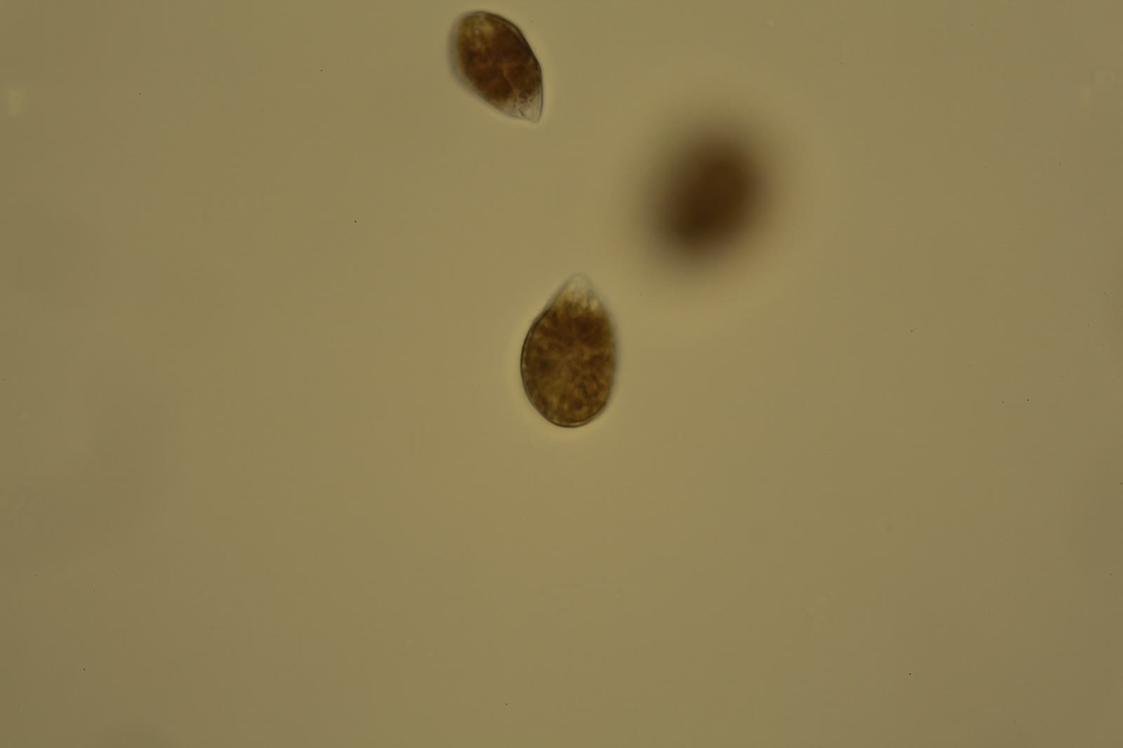 Ostreopsis sp. cells at high magnification