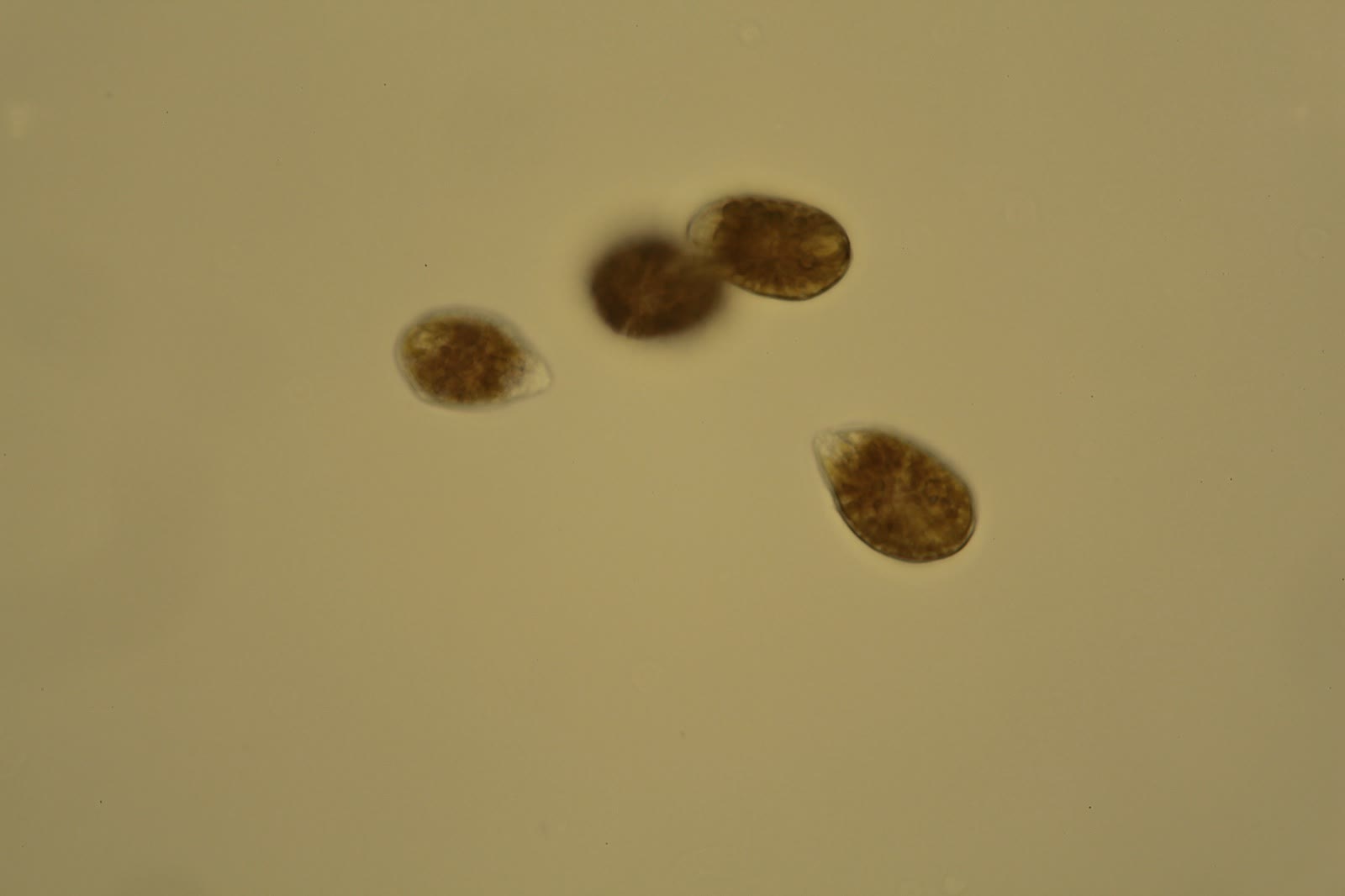 Ostreopsis sp. cells at high magnification