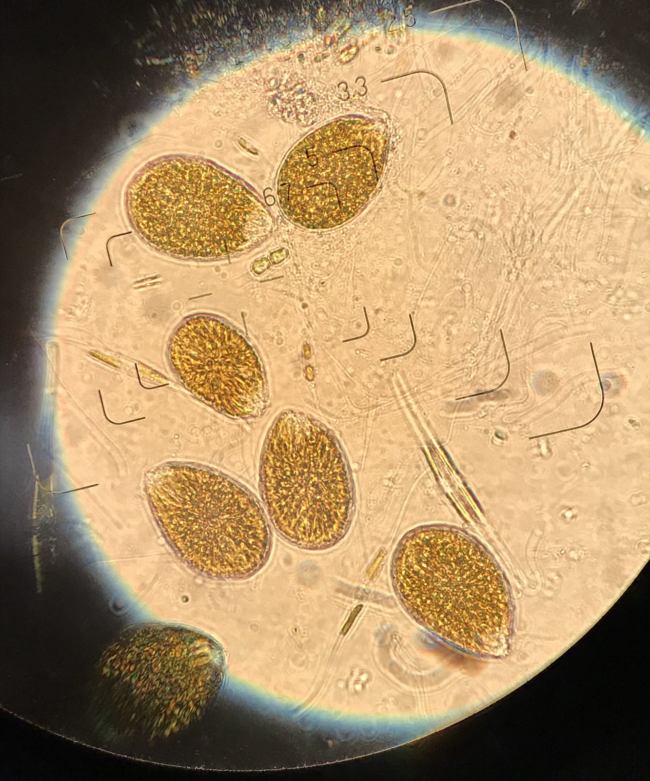 Ostreopsis cells with eyepiece graticule marks
