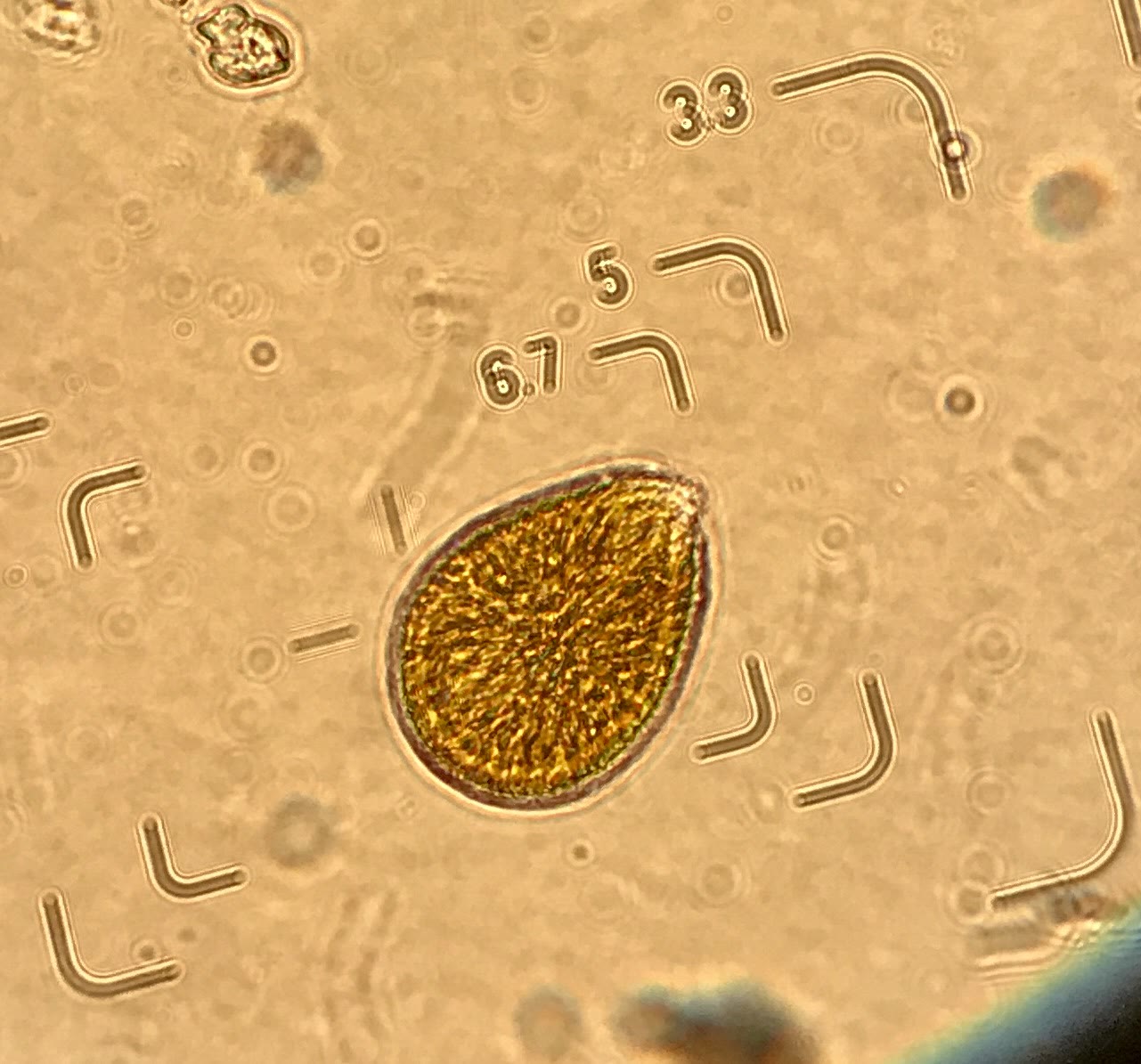 Ostreopsis cells with eyepiece graticule marks