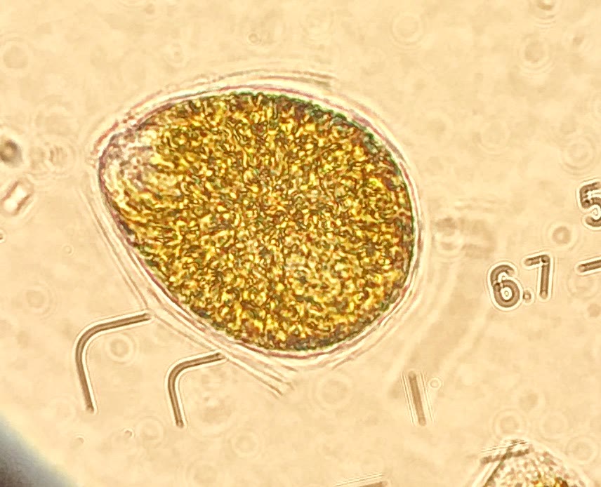 Ostreopsis cells with eyepiece graticule marks