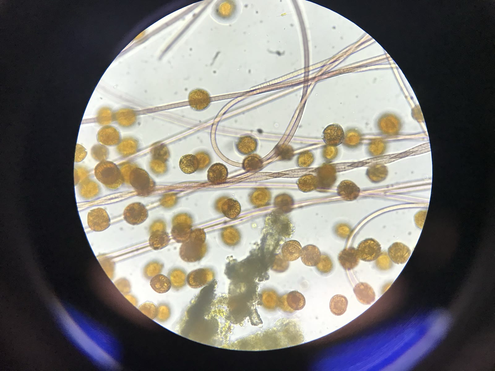 Round cells with mucus strands